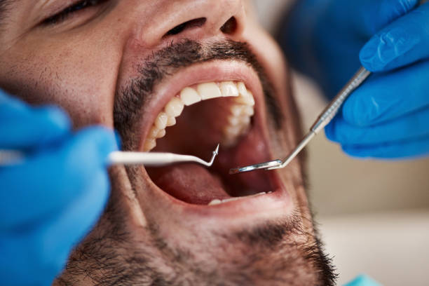 Best Emergency Dental Services for Seniors in East Chicago, IN